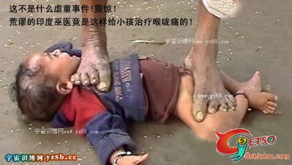 殘忍印度巫醫踩踏小孩治喉嚨圖片3