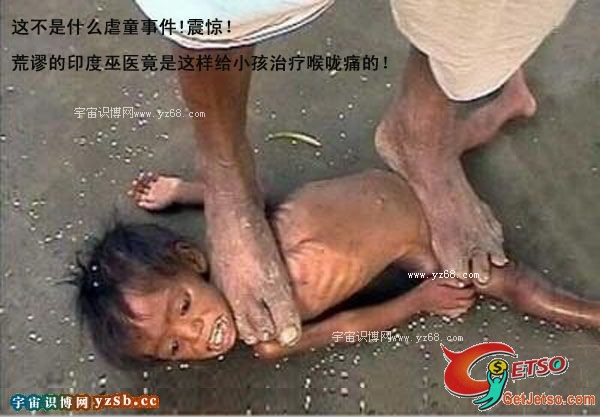 殘忍印度巫醫踩踏小孩治喉嚨圖片4