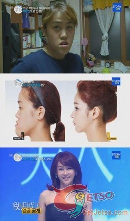 戽斗女變正妹金泰熙 韓國整形節目超神奇圖片2