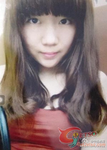 19歲正妹:為去除青春痘,腫成豬頭差點毀容圖片1