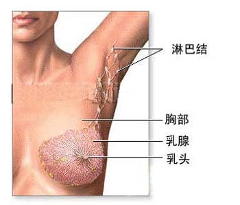 不要亂拔或剃腋毛？姐妹們，讓我們遠離乳癌圖片2