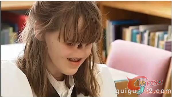 美國怪異女孩天生無眼無鼻圖片1