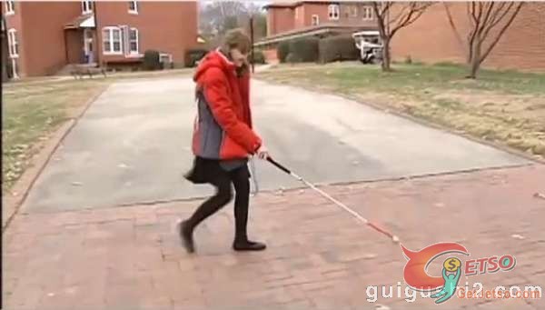 美國怪異女孩天生無眼無鼻圖片3