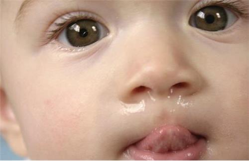 寶寶鼻涕流不停，舒緩嬰兒鼻水方式圖片1