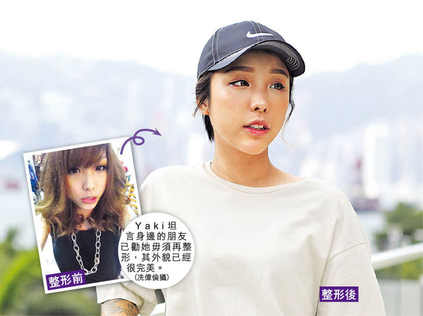 6年微整形30次美少女告誡:太年輕勿試圖片4